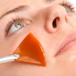 Chemical Peels
